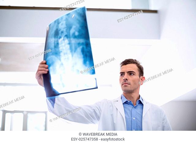 Doctor examining x-ray of patient
