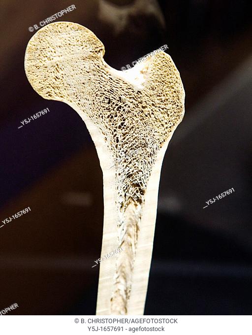 Cross section view of a human femur bone showing trabeculae