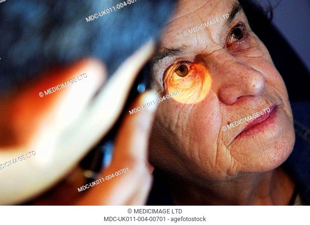A patient undergoes an optometry exam during which the eye is illuminated to reveal the state of the cornea, retina and lens