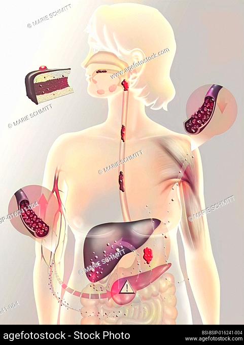 Secretion of insulin on a person with diabetes type 2. Diabetes type 2 (or non-insulin-dependent) is a form of diabetes mellitus affecting mainly adults over 40...