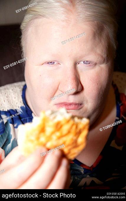 Albino woman holding a partially eaten buttermilk biscuit