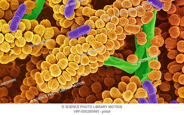 Streptococcus bacteria. Animated coloured scanning electron micrograph (SEM) of chains of Streptococcus bacteria. Streptococcus bacteria are an example of cocci...