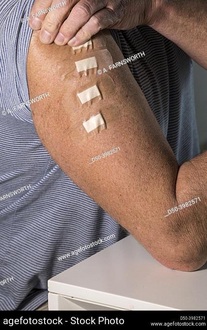 A man's arm with four bandaids, representing four innoculations, including a booster shot