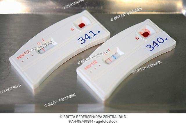 Two test strips of HIV quick tests can be seen coloured after application of the blood of two young men, the test with the number 341 indicates a negative...