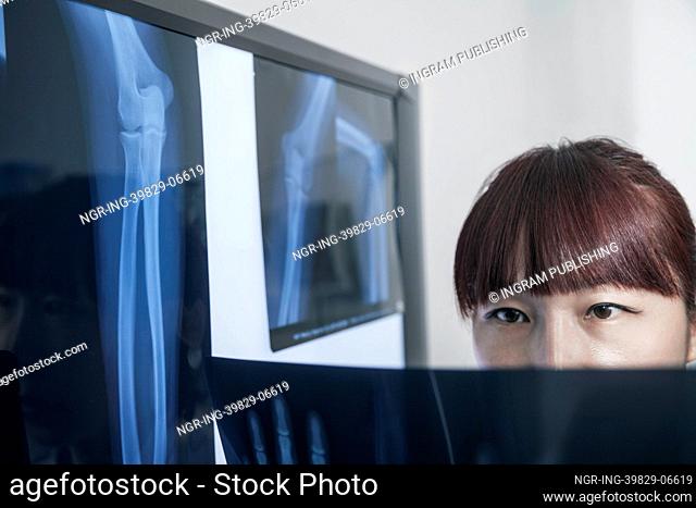Female doctor looking at x-ray of human bones
