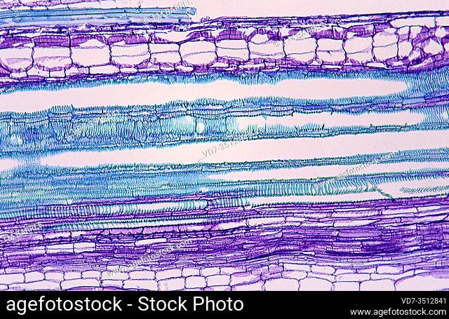 Phloem (purple) and xylem (blue) on a stem longitudinal section. Photomicrograph of pumpkin tissue