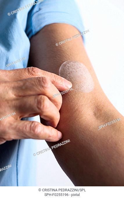 Woman applying a hormone replacement therapy (HRT) patch to her arm. This transdermal patch slowly administers the hormone oestrogen into the bloodstream