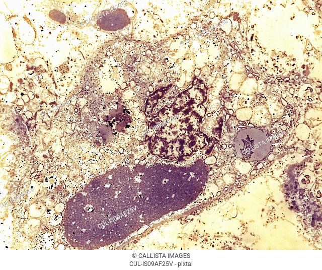 Ebola virus in a specimen of human liver tissue