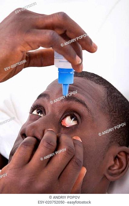 African Man Using Eye Dropper