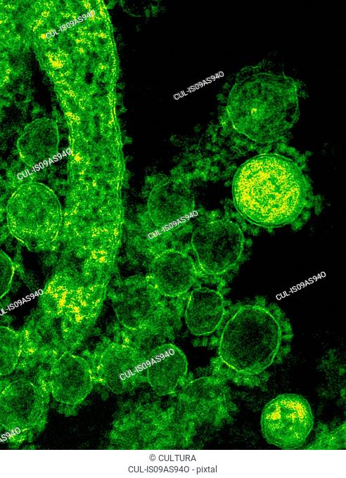 Colorized transmission electron micrograph (TEM) showing spherical-shaped Middle East Respiratory Syndrome Coronavirus (MERS-CoV) virions