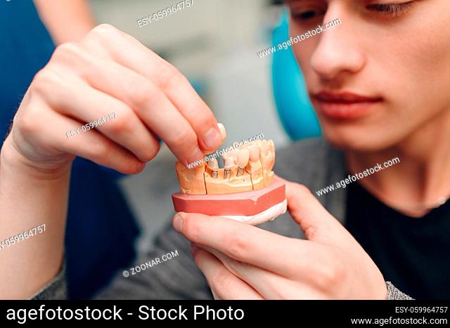 Dentistry. Dentist shows implants to patient. Dental clinic