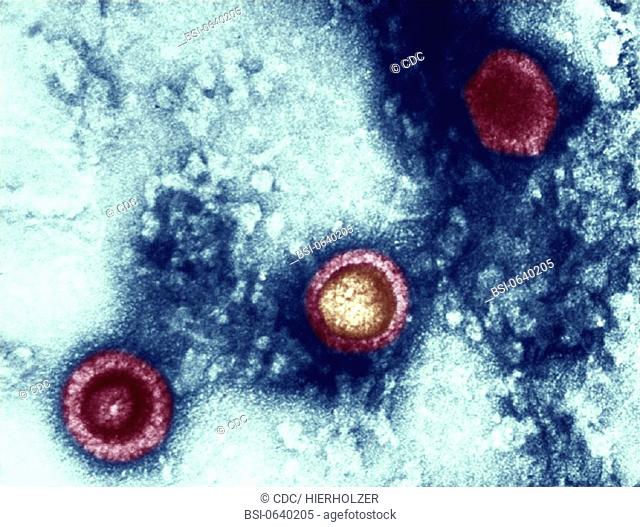 HERPES VIRUS<BR>This transmission electron micrograph from a pelleted specimen depicts three icosahedral-shaped herpes virus virions