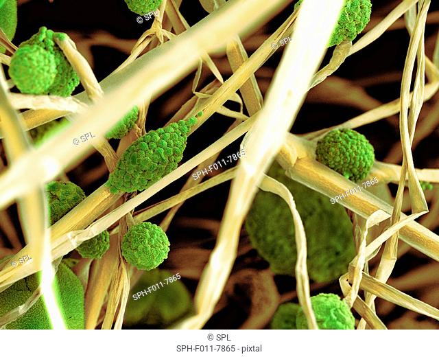 Coloured scanning electron micrograph (SEM) of fungal cells. The round structures are sporangia, which house the fungus' reproductive cells (spores)