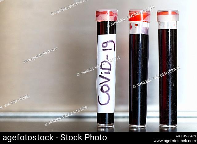 Test tube with blood of positive COVID-19 test and laboratory sample of blood testing for diagnosis new Corona virus infection. Macro
