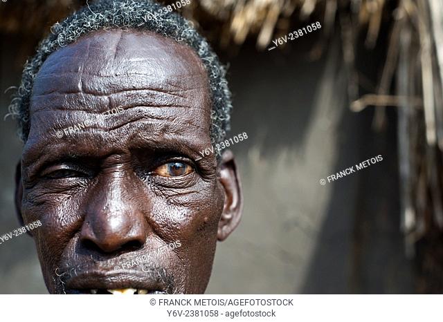 Man belonging to the Nuer tribe. Gambela Ethiopia. He has traditional scars on his forehead as a sign of belonging, a tribal identification