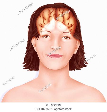 BRAIN, DRAWING Brain  right and left cerebral hemispheres separated by the longitudinal fissure set up in a woman's face
