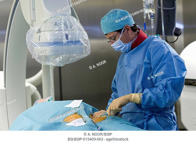 Reportage in the Interventional Cardiology and Rythmology service in Saint George Clinic in Nice, France. Radiofrequency ablation of cardiac arrhythmia using...