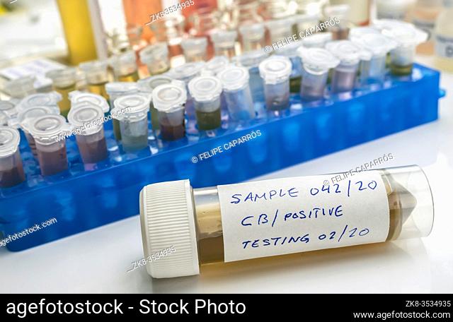 Samples contaminated by Clostridium botulinum toxin that causes botulism in humans, laboratory research, conceptual image