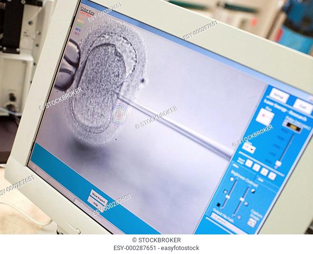 Monitor showing intra cytoplasmic sperm injection selective focus