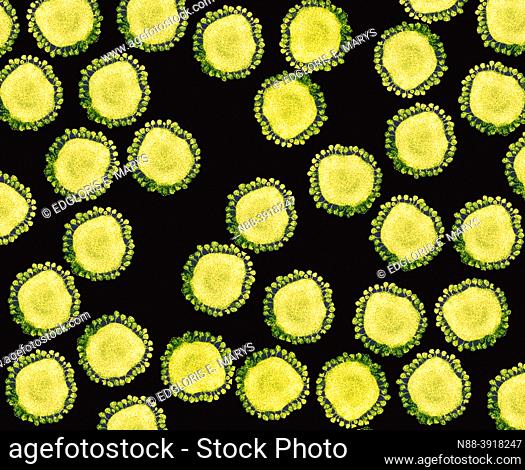 Purified coronavirus Covid-19 particles under transmission electron microscopy (TEM)