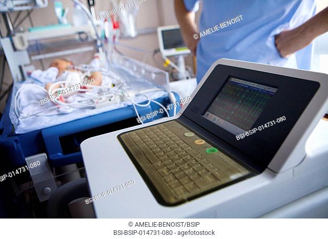Reportage in the level 2, neonatology service in a hospital in Haute-Savoie, France. A newborn baby showing heart beat irregularities takes an ECG
