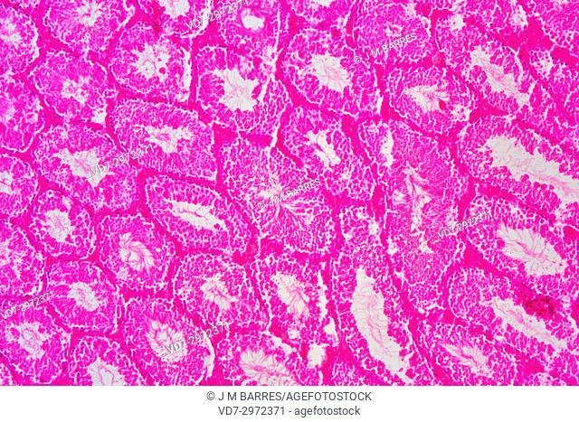 Human testicle or testis section showing seminiferous tubules, Leydig cells, Sertoli cells, spermatocytes, spermatogonia, spermatides and spermatozoon