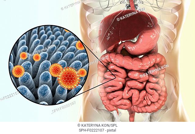 Rotaviruses infecting intestine, illustration