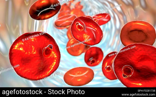 Plasmodium malariae inside red blood cell, illustration