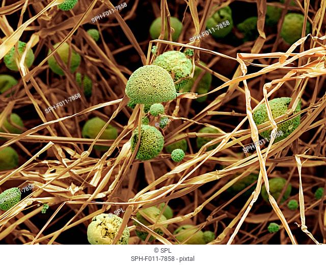 Coloured scanning electron micrograph (SEM) of fungal cells. The round structures are sporangia, which house the fungus' reproductive cells (spores)