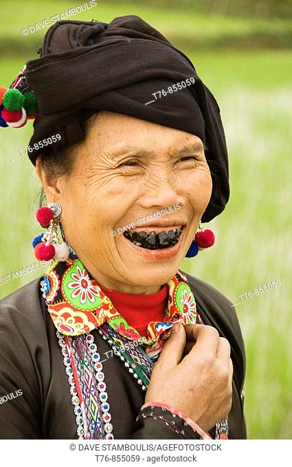 the black teeth of a Black Lu hilltribe woman in Tam Duong Vietnam The married Lu women color their teeth with lacquer from trees to prevent tooth decay and as...
