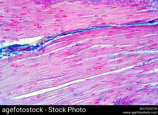 Human smooth muscle, light micrograph