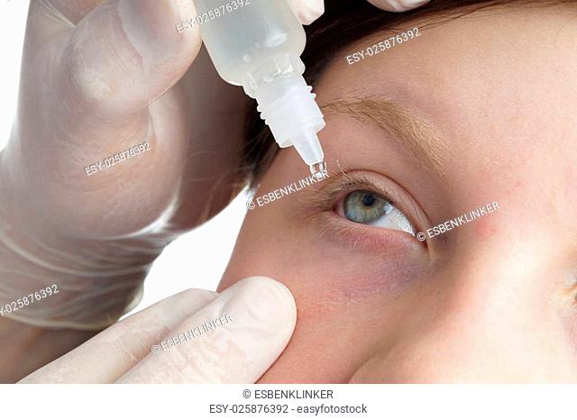 Nurse giving a child eye drops. Medical procedure