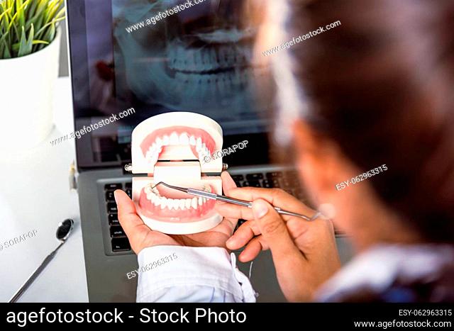 Oral dental hygiene. Dentist female holding professional stomatology tool and pointing healthy tooth model and explaining patient at clinic office and teeth...