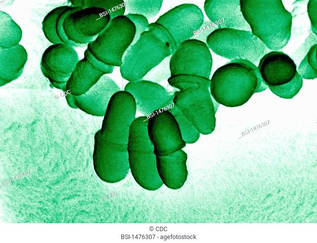Yeats of the genus Malassezia colorized SEM. Malassezia are lipophilic yeasts, belonging to skin flora saprotroph resident flora that can be the cause of...