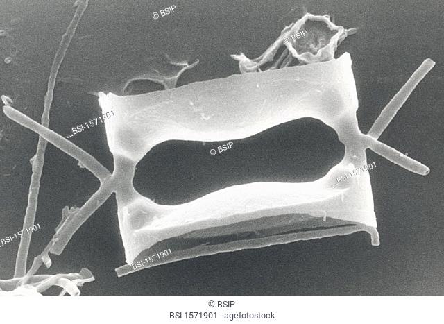 PLANKTON, SEM<BR>Centric diatom. Lateral view of chaetoceros valve. SEM 7800x
