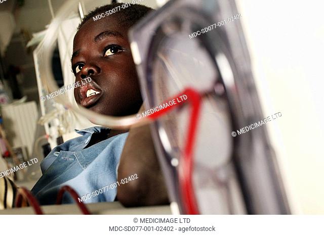 A young boy attached to a dialysis machine. The kidney dialysis machine acts as an artificial kidney. It extracts blood from the patient to remove waste...