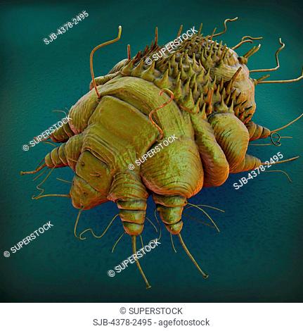 A close up view of the cause of scabies - the mite Sarcoptes scabiei