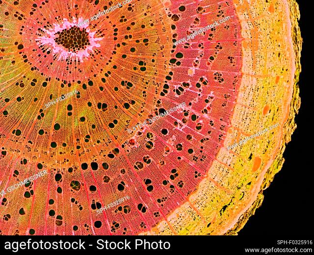 Elm stem. Light micrograph (LM) of a cross-section through a woody stem of an elm (Ulmus procera) tree. This shows the thick layer of cork (phellem) on the...