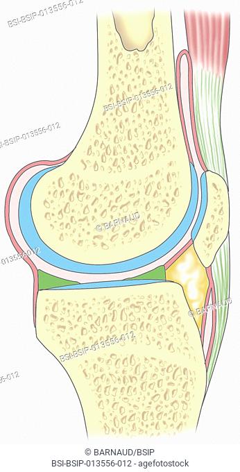 A cross-section illustration of the knee showing ligaments, articular capsule, cartilage, meniscus, femur, tibia and knee cap