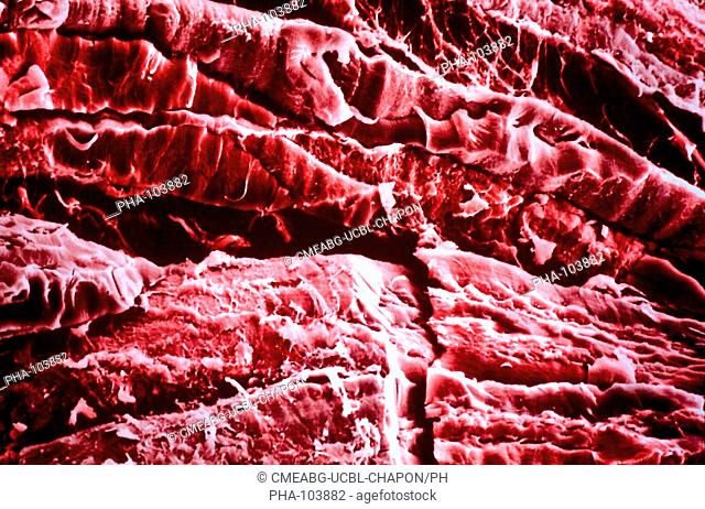 Coloured Scanning Electron Micrograph SEM of muscle tissue affected by muscular dystrophy. Muscular dystrophy is a genetic disorder typified by muscle wasting...