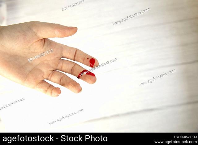 hand injury with blood, blood wound cut top view, copy space, medical concept needs stitches space for text