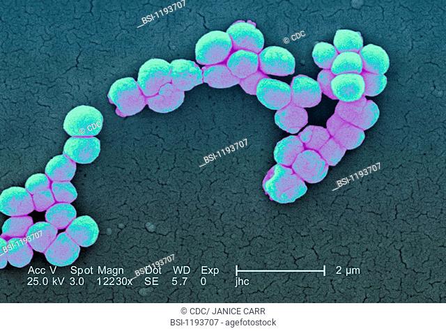 MICROCOCCUS LUTEUS Micrococcus luteus, scanning electron micrograph colorized SEM, x 12 230, the line represents two microns