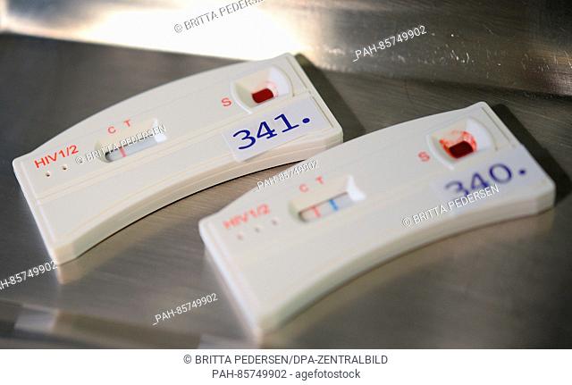 Two test strips of HIV quick tests can be seen coloured after application of the blood of two young men, the test with the number 341 indicates a negative...