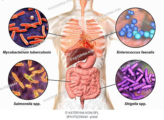 Computer illustration showing bacteria that cause infections of respiratory system, heart (endocarditis) and digestive tract