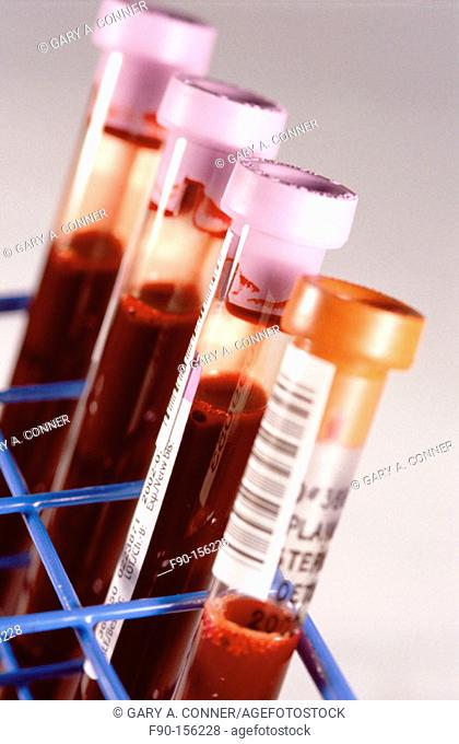 Test tubes with blood