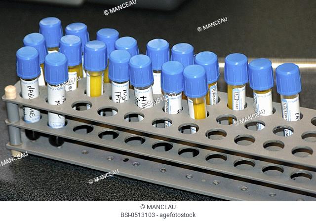BLOOD ANALYSIS<BR>Photo essay from laboratory
