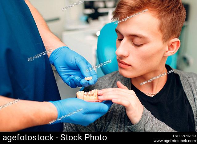 Dentistry. Dentist shows implants to patient. Dental clinic