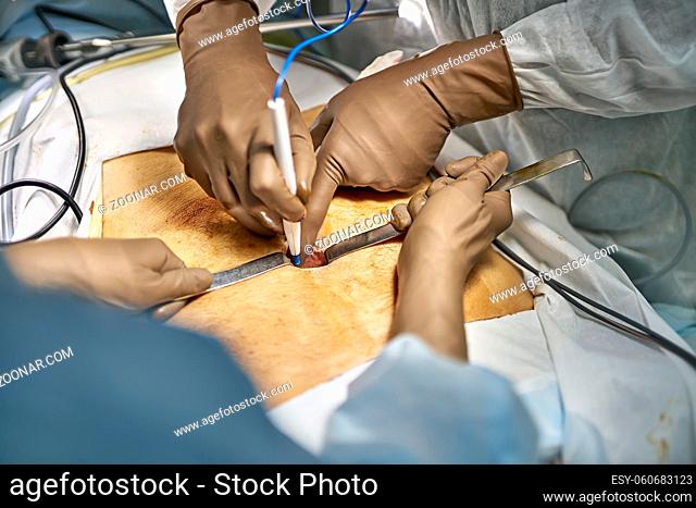 Assistant is using surgical retractors to expand the incision on the patient's stomach while doctor is using a laser scalpel