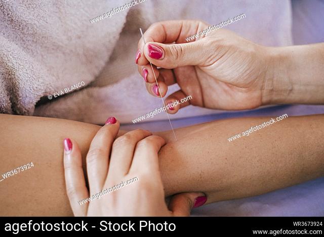 Close-up of woman inserting acupuncture needles in female customer's arm on table