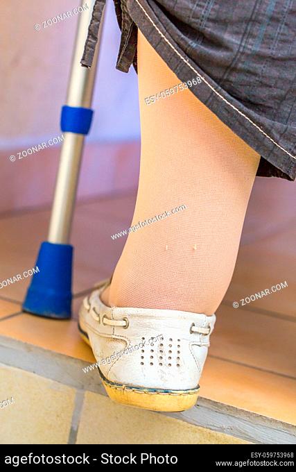 age disabled woman with a crutch wearing compression stockings to improve blood circulation in her legs